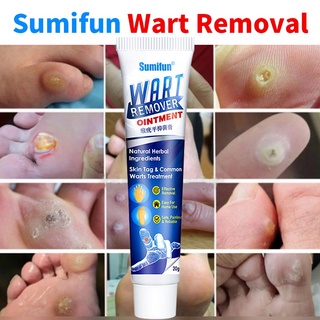 Sumifun Body Warts Remover Cream Skin Tag Remover Corn Plaster  Antibacterial Warts Ointment | Shopee Philippines