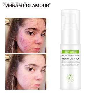 【Factory price】▧VIBRANT GLAMOUR Tea Tree Oil Acne Pimples Scars Treatment Facial Toner 30ml #9