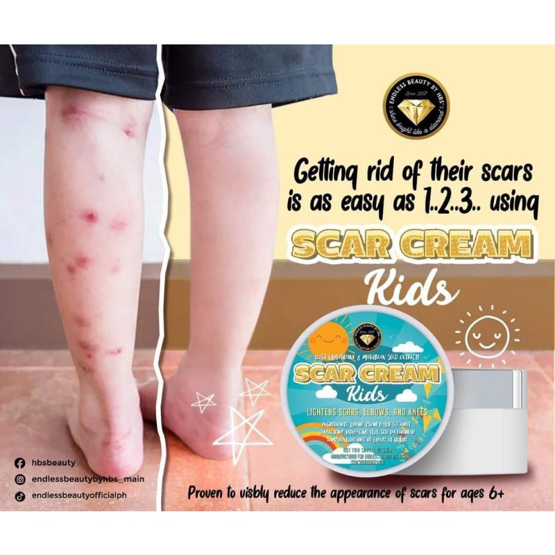 Scar kids endless beauty by hbs Scar removar for kids Shopee Philippines