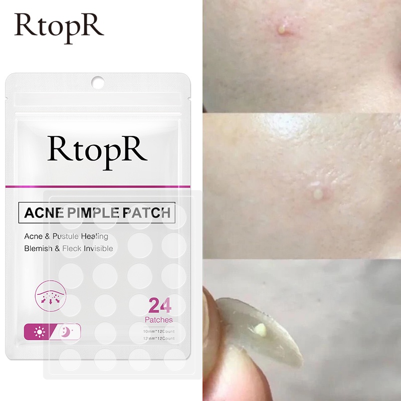 RtopR Acne Pimple Patch Invisible Acne Treatment Stickers Treatment Pimple Remover Tool Skin Care Waterproof 24 Patches Daily And Night Use