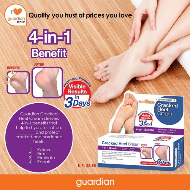 cracked heel ointment