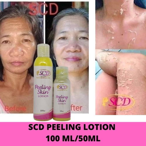 SCD PEELING SKIN LOTION BIG 100ML & SMALL 50ML Shopee Philippines