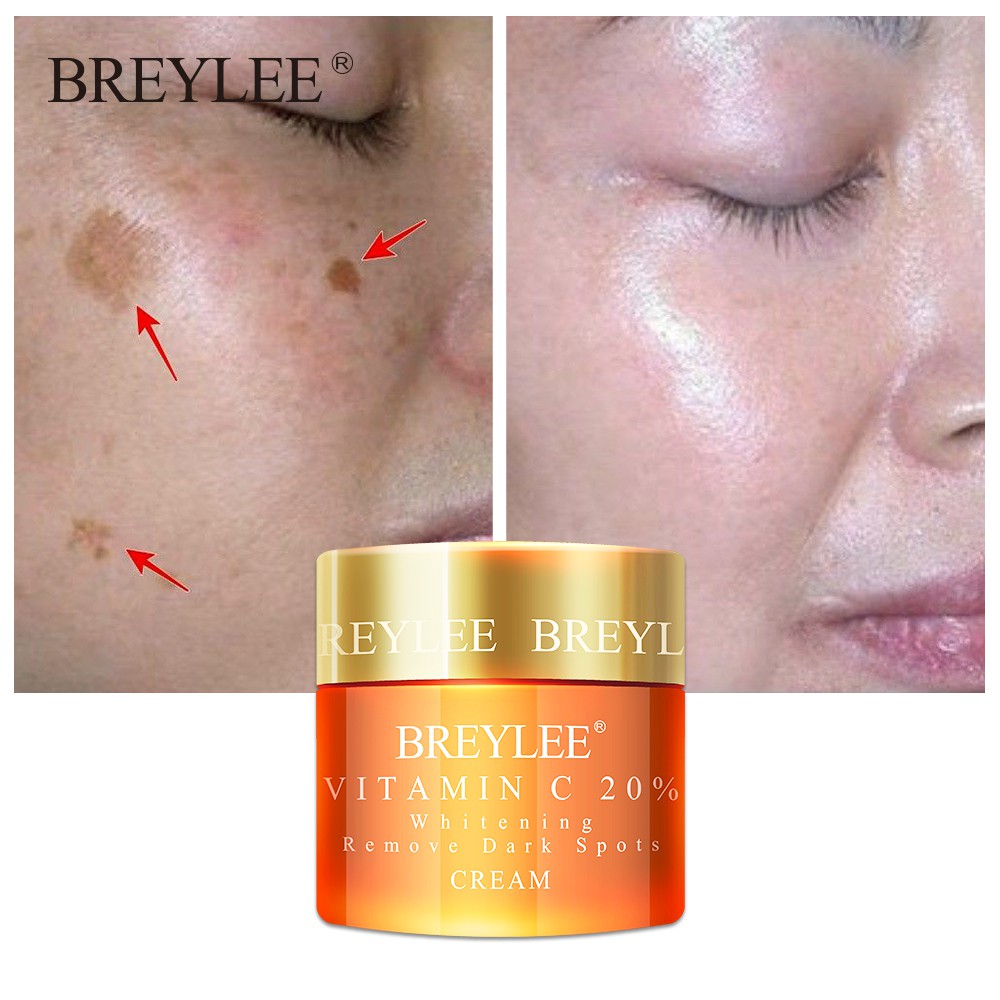 BREYLEE Vitamin C Face Cream Whitening Facial VC Freckles Remove Dark 