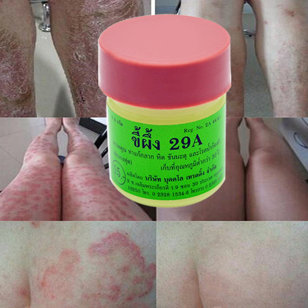 Sumifun Skin Problems Treatment Eczema Cream Ringworm Dermatitis Ointment Antibacterial Cream 