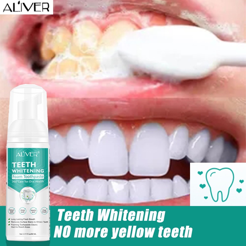 Aliver Teeth Whitening Mousse Foam Toothpaste Stain Removal Bright ...