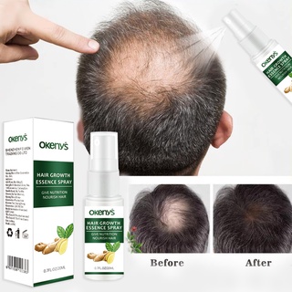 Hair grower spray men and women hair care anti-hair loss and anti ...