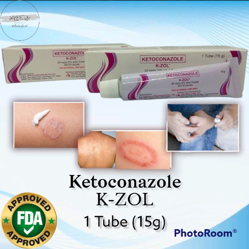 > K-ZOL KetoconazoleAntifungal Cream 1 Tube(15g) | Shopee Philippines