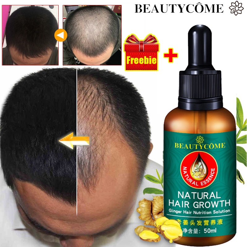 BEAUTYCOME Hair Growth Serum Fast Hair Growth Oil Hair Loss Teatment Hair  Grower for Men/Women | Shopee Philippines
