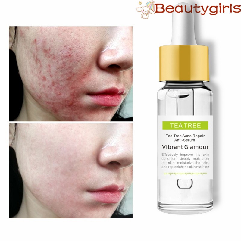 serum that helps with acne scars