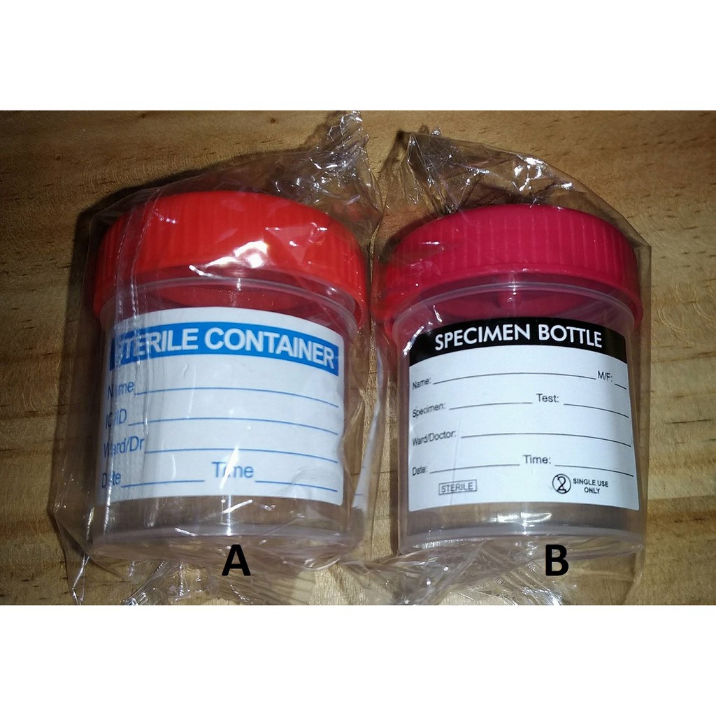 Urine Specimen Container with Label (Sterile, 60ml capacity) Shopee