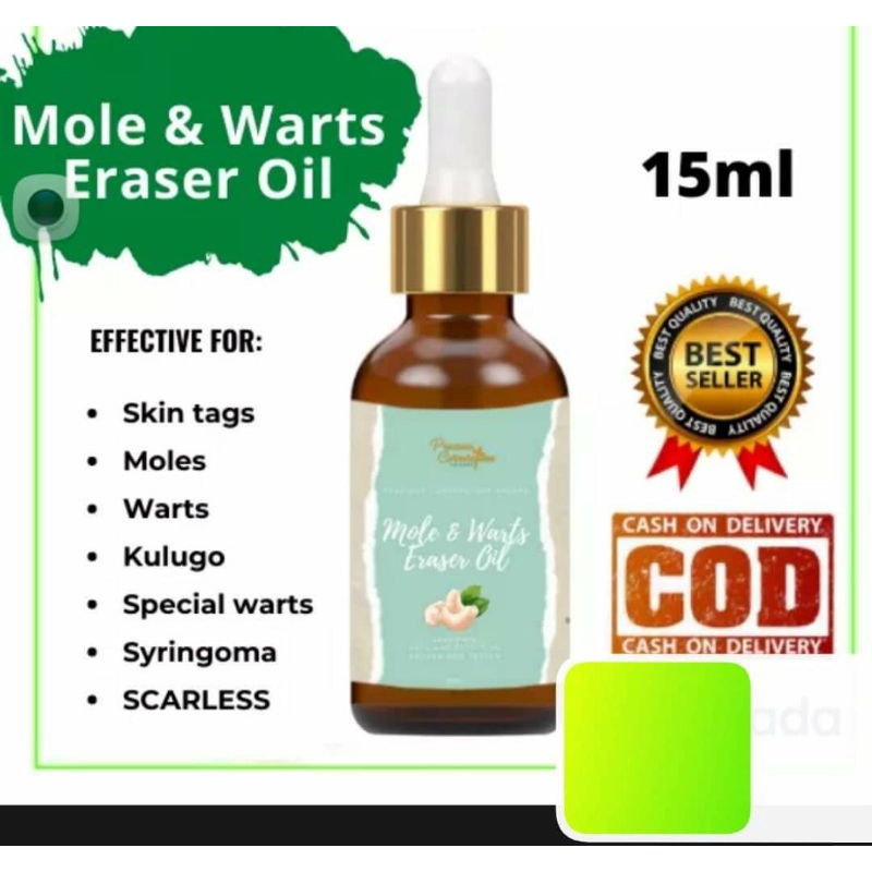Breadmaxine Kasoy Oil Skin Wart Remover Mole Nunal Skin Tag Kulugo