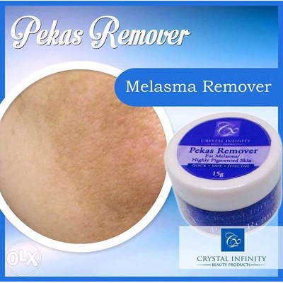 melasma cream watson