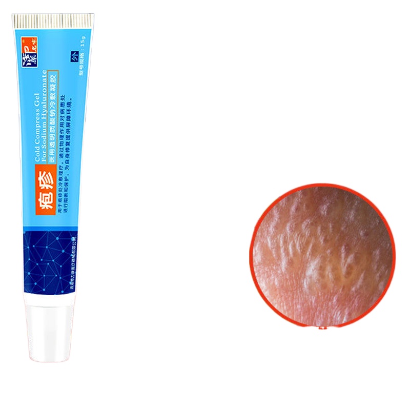 Shingles Cream 15g Treatment Genital Herpes Natural Formula Herpes Medicine gamot sa buni for