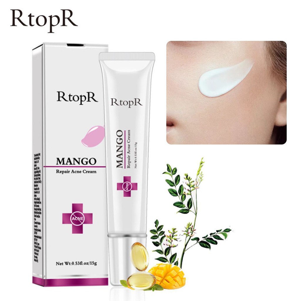 rtopr mango acne cream