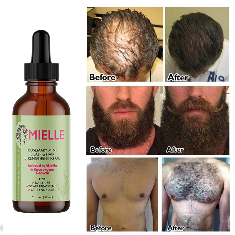 mielle-organics-rosemary-mint-scalp-hair-strengthening-serum-helps