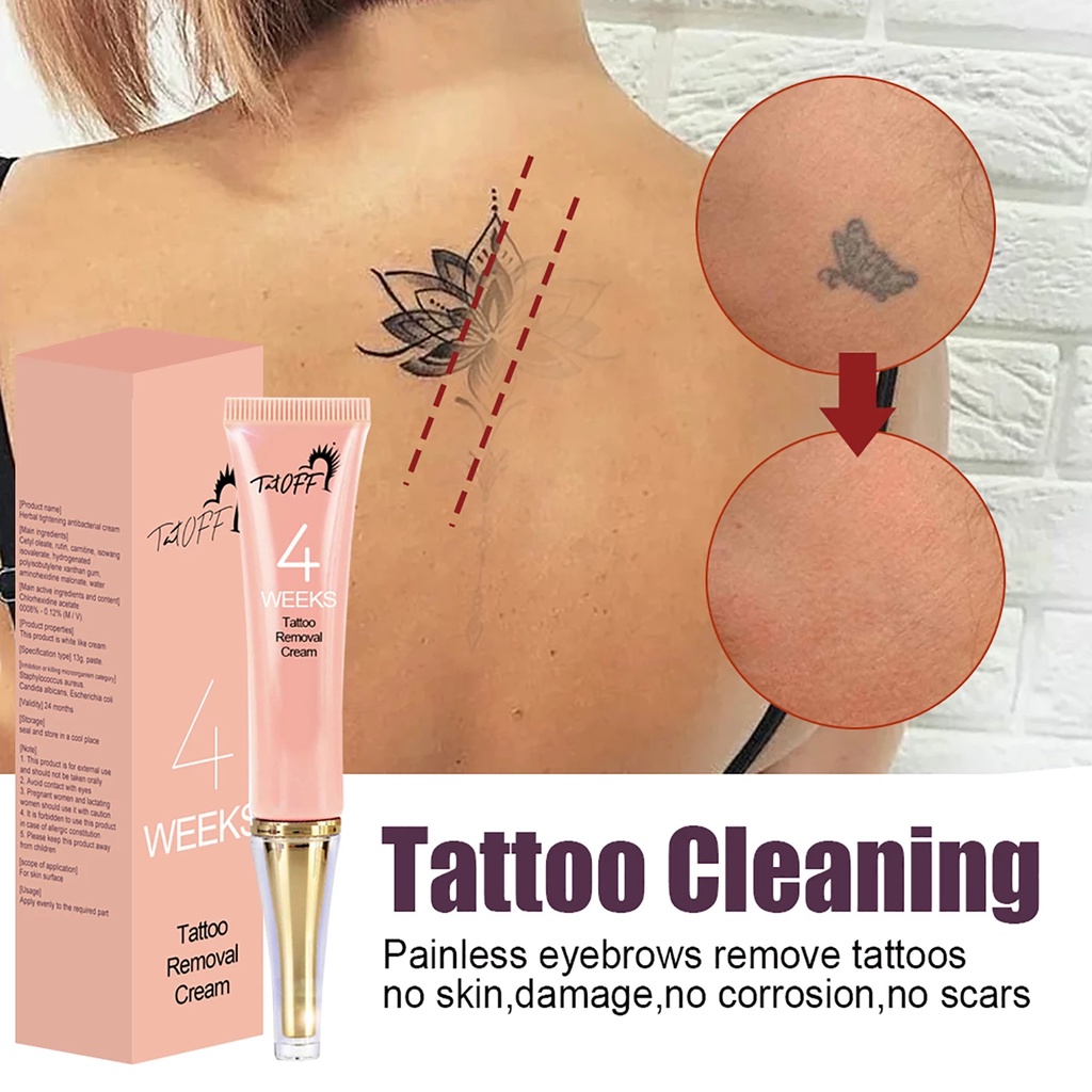 Permanent Tattoo Removal Cream Safe Moisturize Skin Tattoos Remover Gel No  Need For Pain Removal Maximum Strength Tattoo Tool | Shopee Philippines