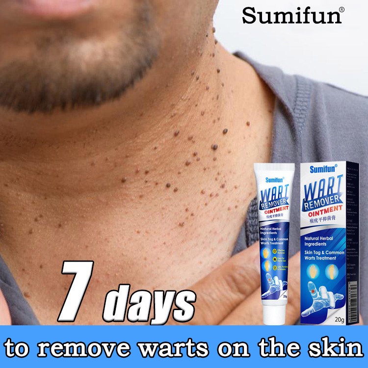 Warts Remover Original Cream Wart Remover Ointment Treatment Skin Mole