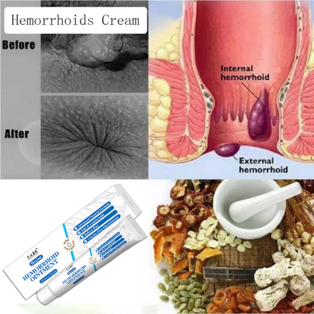  Preparation H Hemorrhoid Symptom Treatment Cream, Multi-Symptom  Pain Relief with Aloe, Tube (0.9 Ounce, 1 Tube per Box), (Pack of 3) :  Health & Household