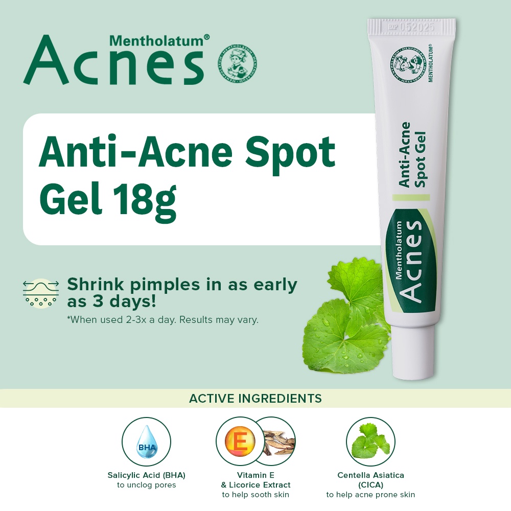 Acnes Anti-Acne Spot Gel 18g - Anti Acne, Spot Gel, Acne Marks, Spot ...