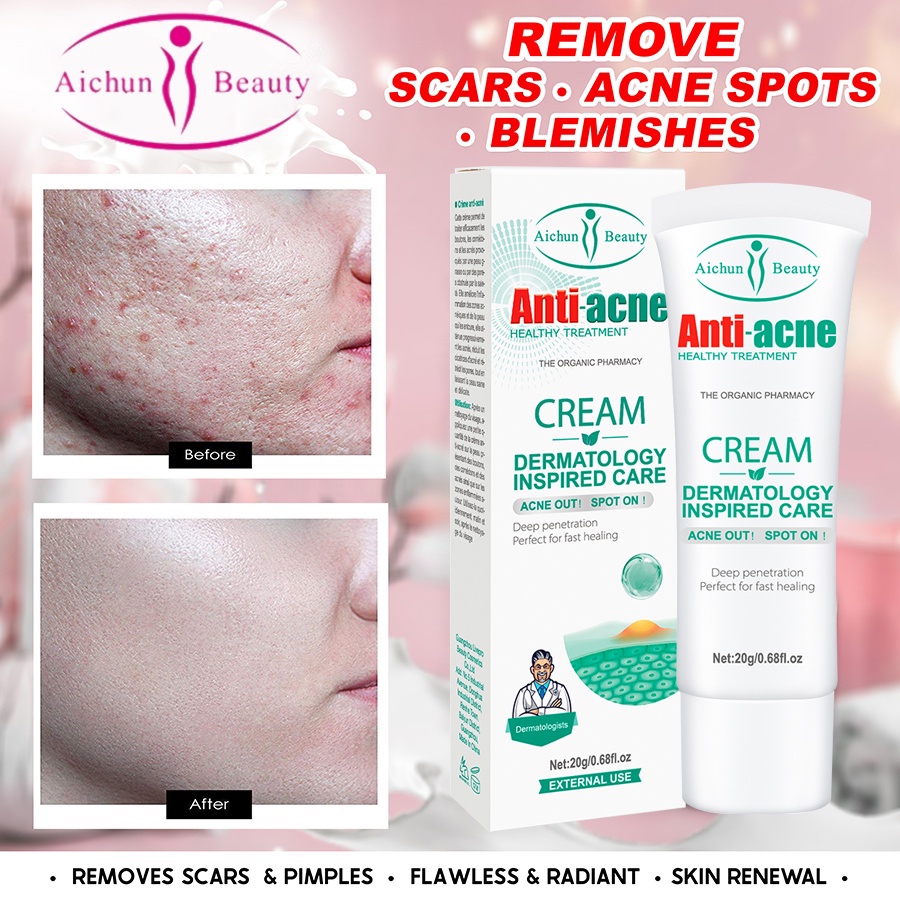 Acne Treatment Acne Scar Remover Facial Cream Skin Care Anti Acne Cream Pores Cream 20g Shopee