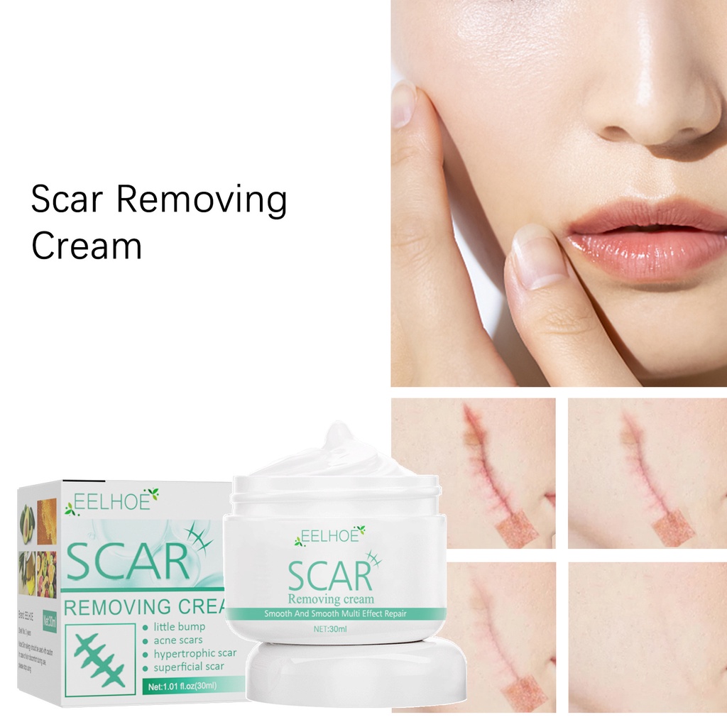 EELHOE Scar Repair Cream Fade Remove Burn Scars Old Postoperative Marks