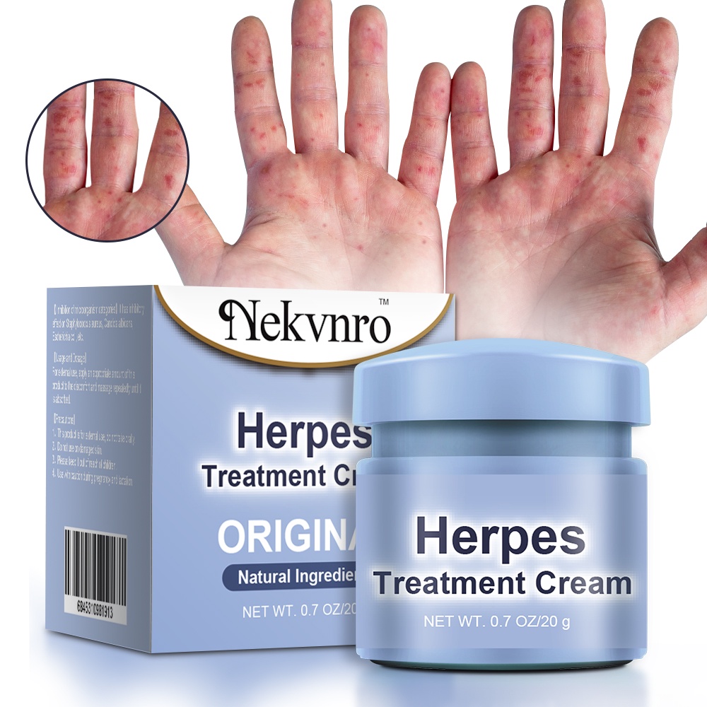 gabapentin cream for herpes zoster