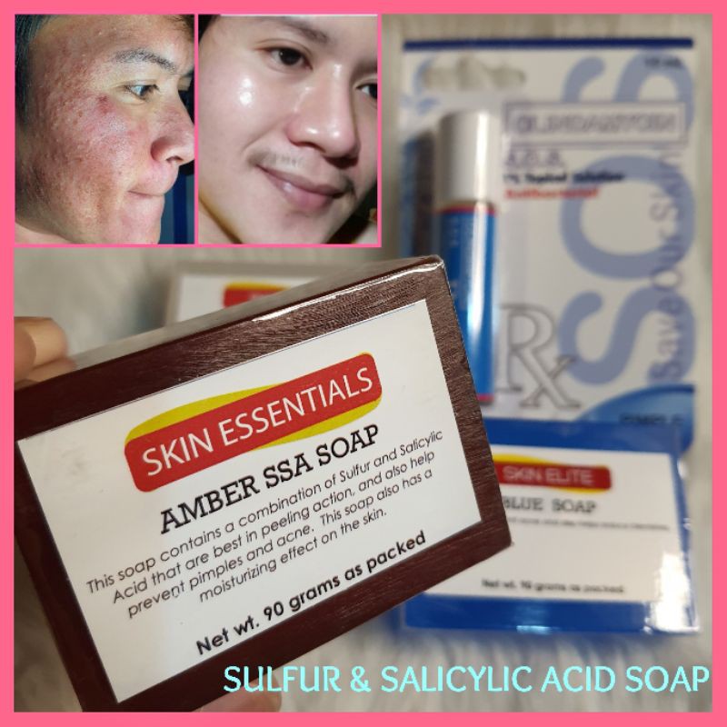 SKIN ELITE (Sulfur & Salicylic Acid Soap) Shopee Philippines