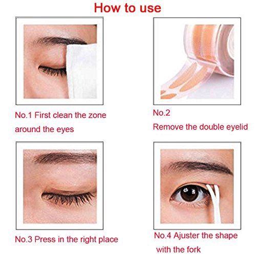 remove double eyelid