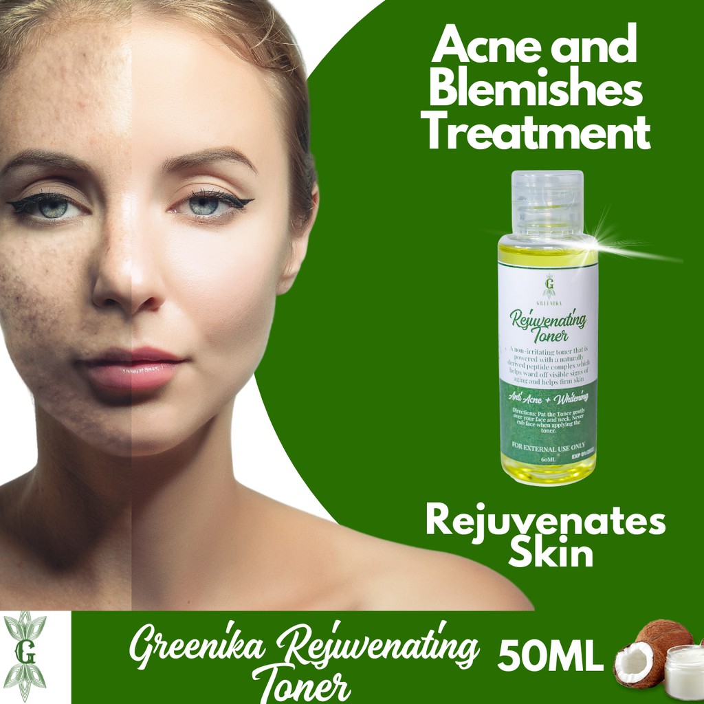 [ANTI ACNE TONER] Greenika Rejuvenating Toner for Whiteheads