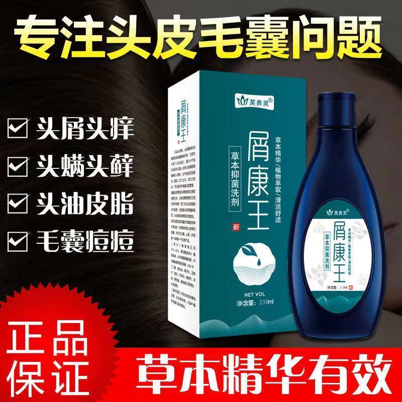 Scalp folliculitis shampoo dandruff seborrheic dermatitis scalp