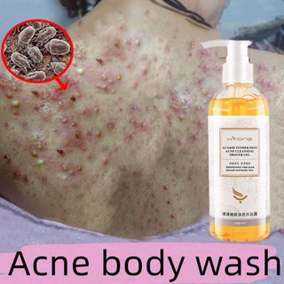 anti mite shower gel