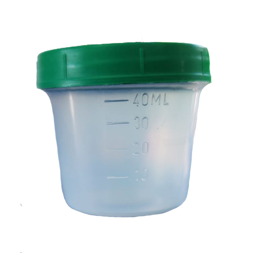 Specimen Bottle for Laboratory (Urine/Stool) | Shopee Philippines