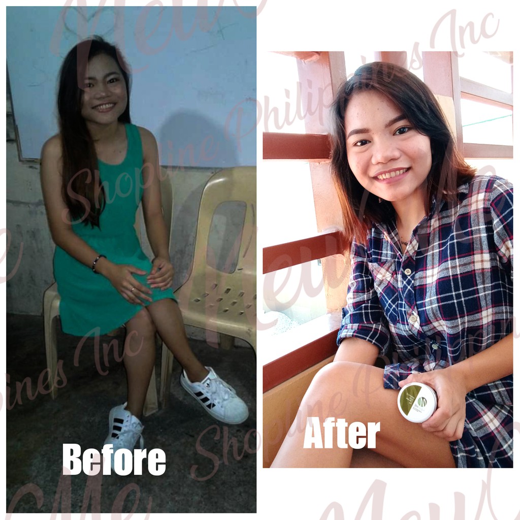 new me miracle cream benefits