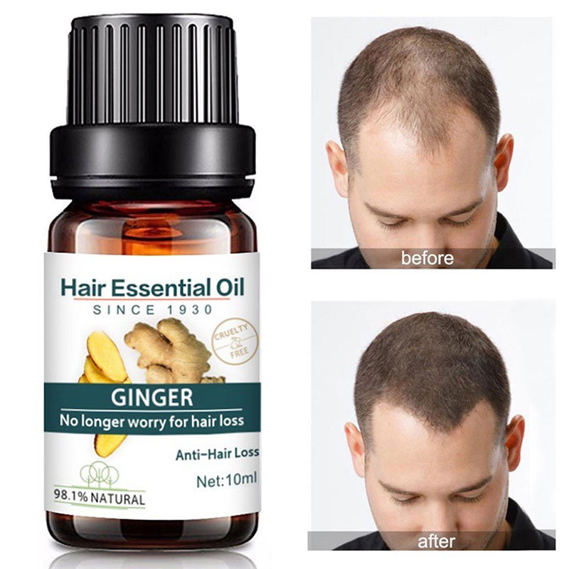 Hair Growth Essential Oils Hair Care Essence Original Authentic 100% Hair  Loss Tonic Health Care | Shopee Philippines
