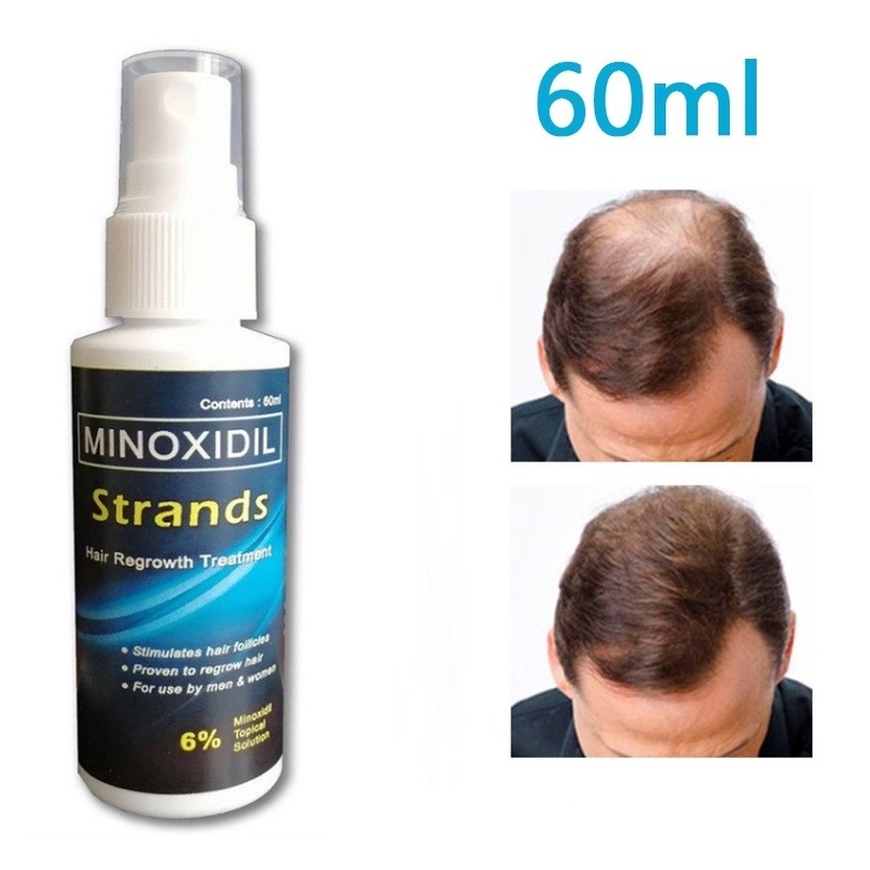 minoxidil - Best Prices and Online Promos - Mar 2023 | Shopee Philippines