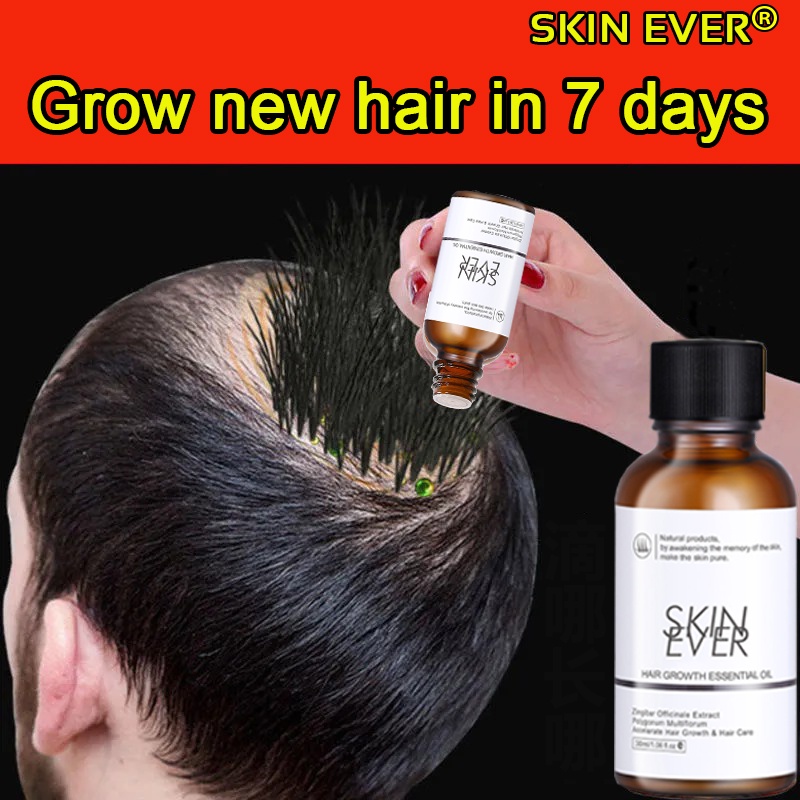 SKIN EVER Hair Growth Essence Hair Care Essential Oil Enhance hair root  nutrition Reduce hair loss | Shopee Philippines