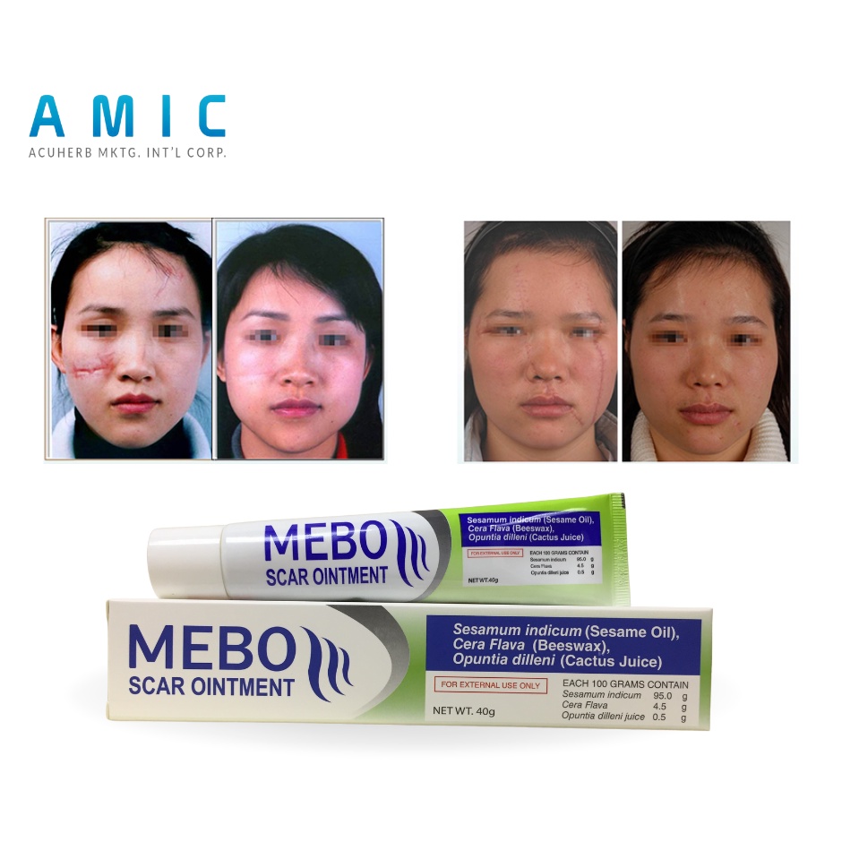 MEBO Scar Ointment 40g For Acne Scar Remover , Keloid Scar Remover