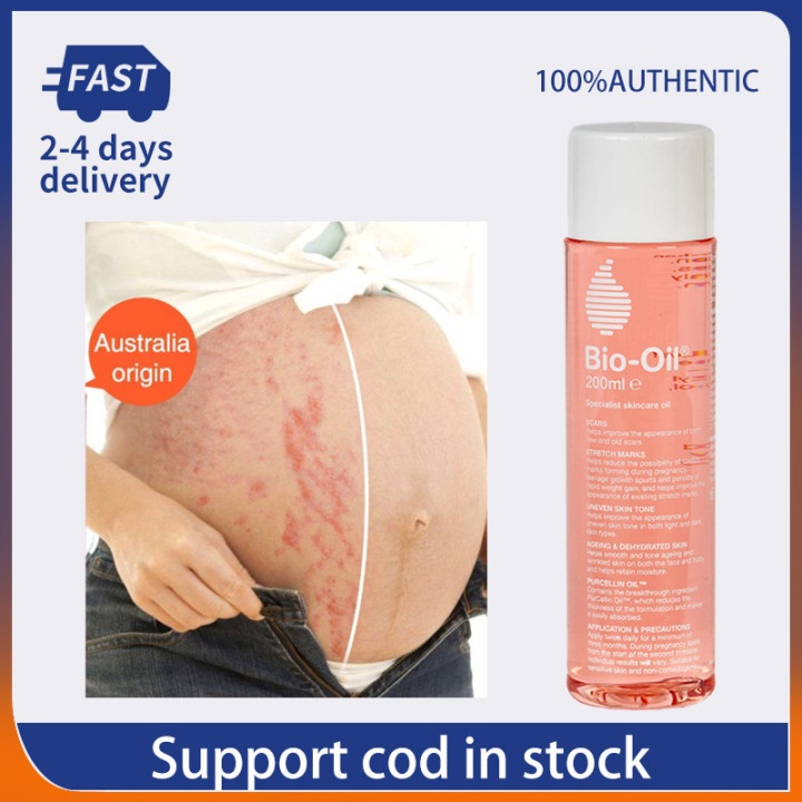 BioOil Skincare for Scar Stretch Mark Treatment Oil Acne Treatment