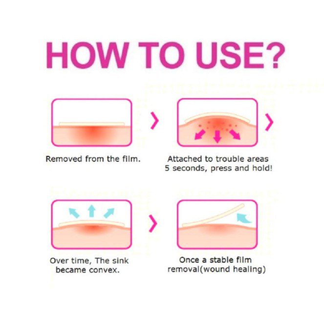 v3H4 Olive Young Careplus Pimple Patch 102pcs Acne Sticker Shopee Philippines