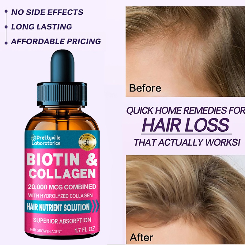 Hair growth essential oil and hair care products can effectively prevent hair  loss and promote rapid hair growth | Shopee Philippines