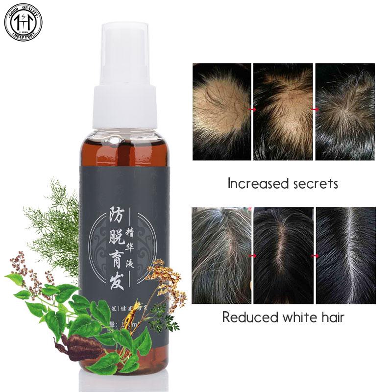 Time Traditional Chinese Medicine 100ml Anti Hair Loss Essence