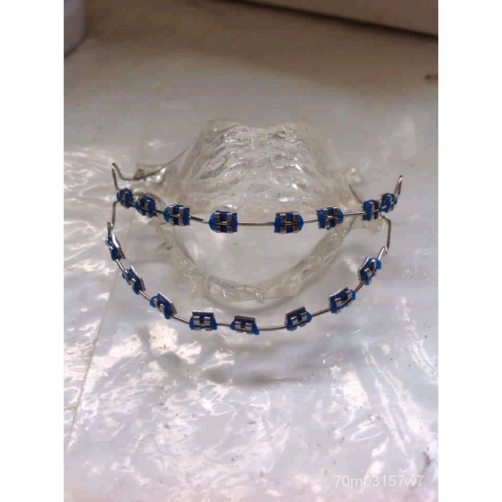 UPPER NORMAL need gums retainer kayo papalagay ng gums Shopee