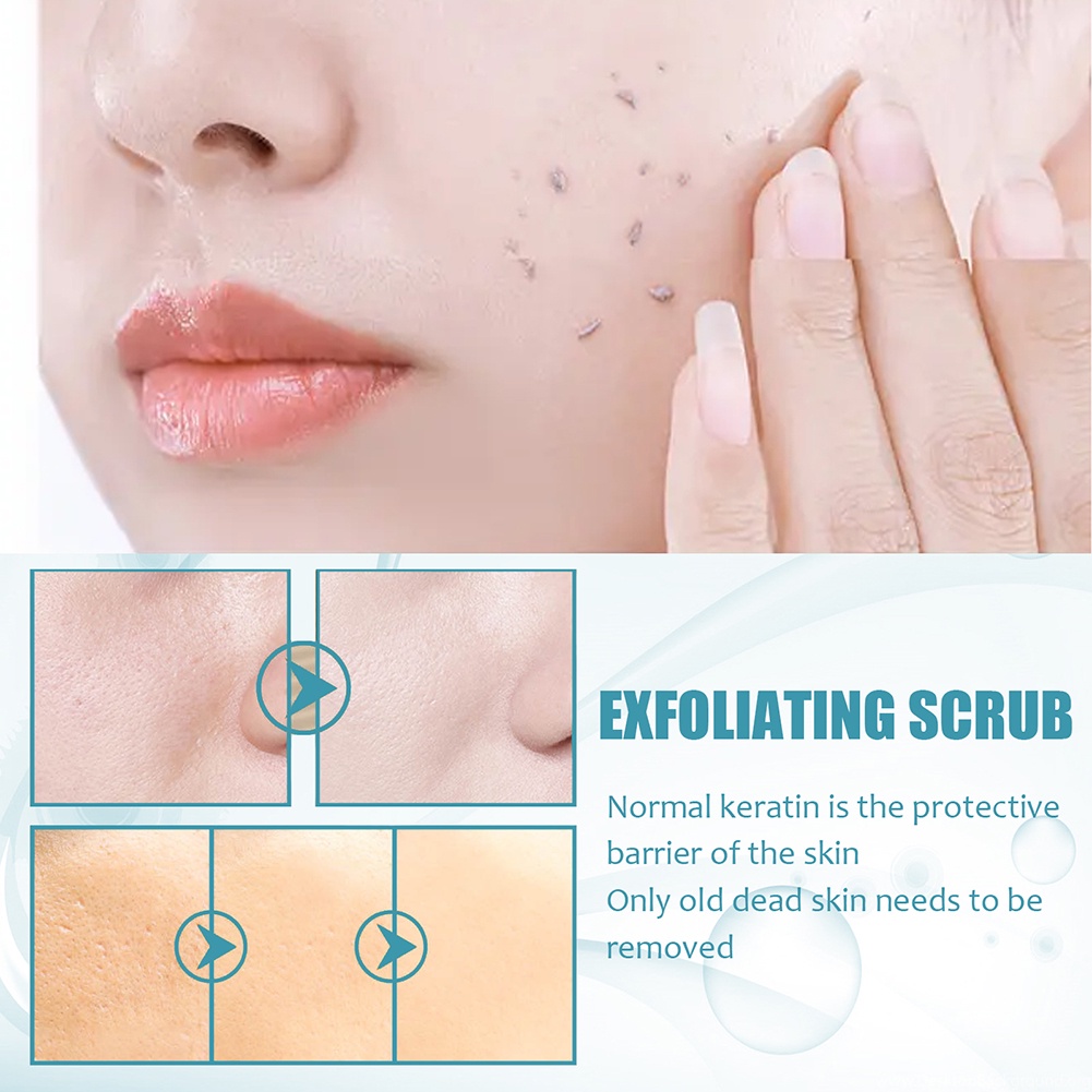 Eelhoe 50g Body Peeling Gel Remove Cutin Clean Pores Exfoliating Scrub Moisturizing Skincare Peeled Skin Rejuvenation Body Lotion