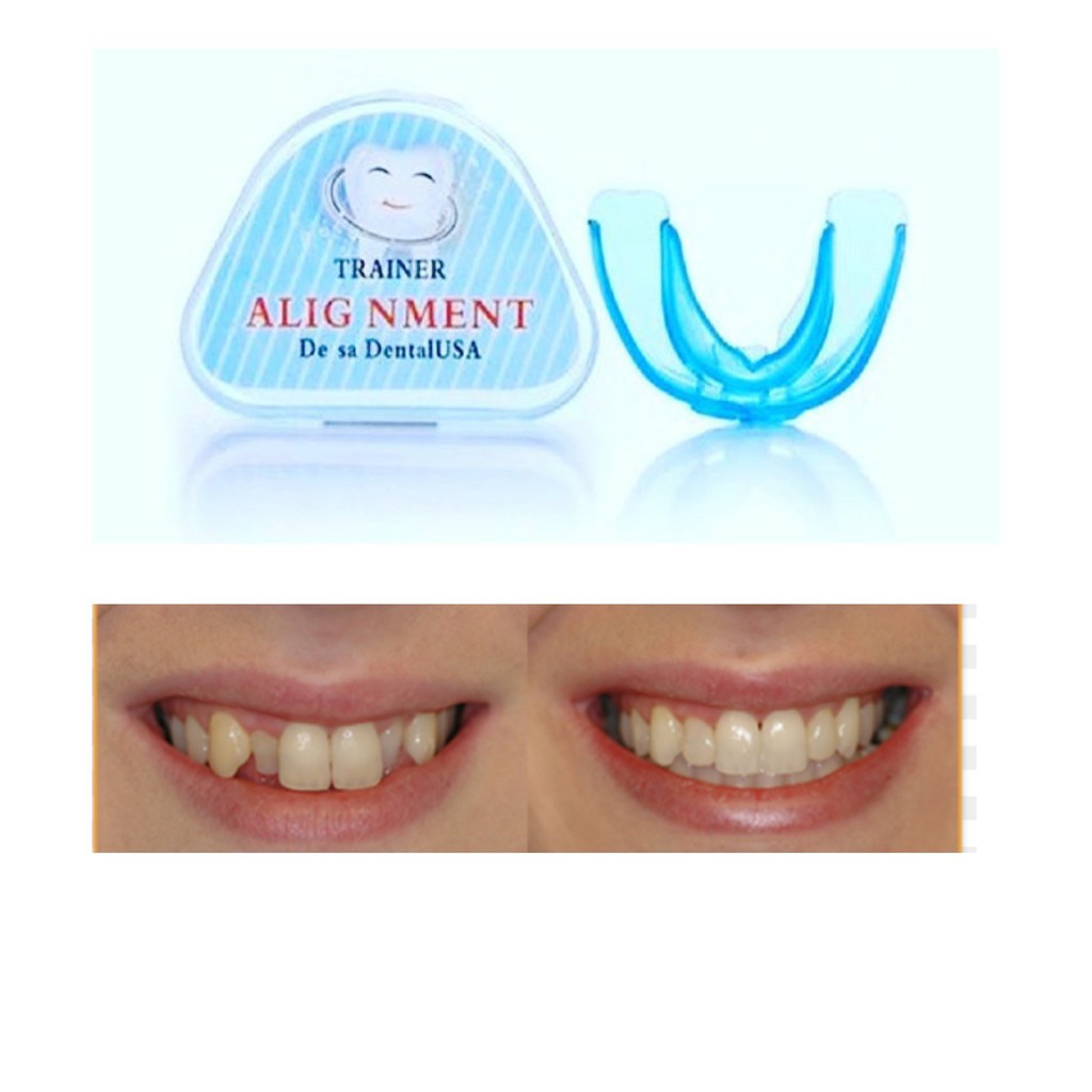 silicone teeth alignment