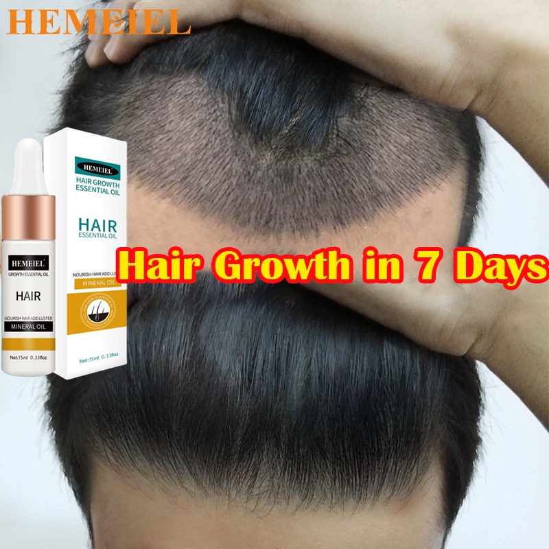 HEMEIEL Novu Hair Grower Pomade For Men Original/Hair Growth Serum Oil ...