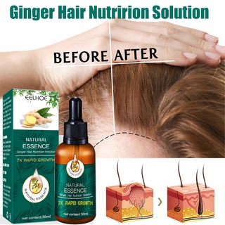 Eelhoe 30ml Hair Growth Ginger Germinal Oil Essential Oil Ready Stock