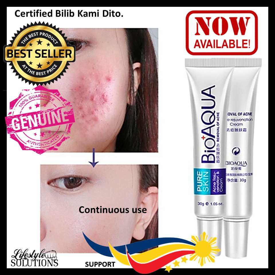 Bioaqua Acne Treatment Luisa Ph Face Cream Skin Care Acne Scar Remover Pores Cream Shopee Philippines bioaqua acne treatment luisa ph face cream skin care acne scar remover pores cream