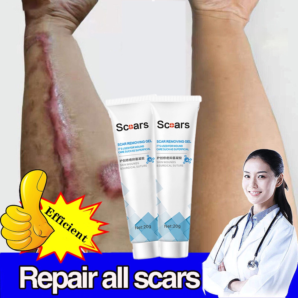 Scar Remover Cream Scar Remover Acne Scar Remover For Face Body Old Scar On Leg Scalded Burn 5560