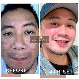 Lumiere Skin Vitals Facial Skin care | Shopee Philippines