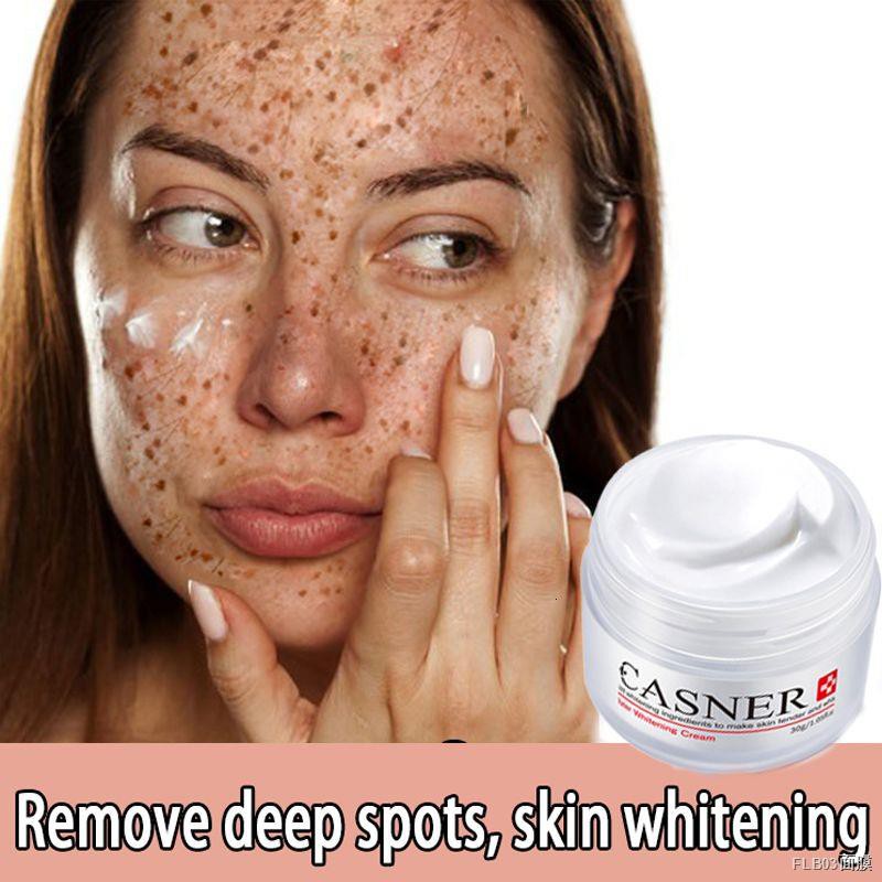 24k Gold Melasma Cream Dark Spot Remover Melasma Removal Cream Original